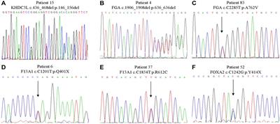 Exome-Sequencing Identifies Novel Genes Associated with Recurrent Pregnancy Loss in a Chinese Cohort